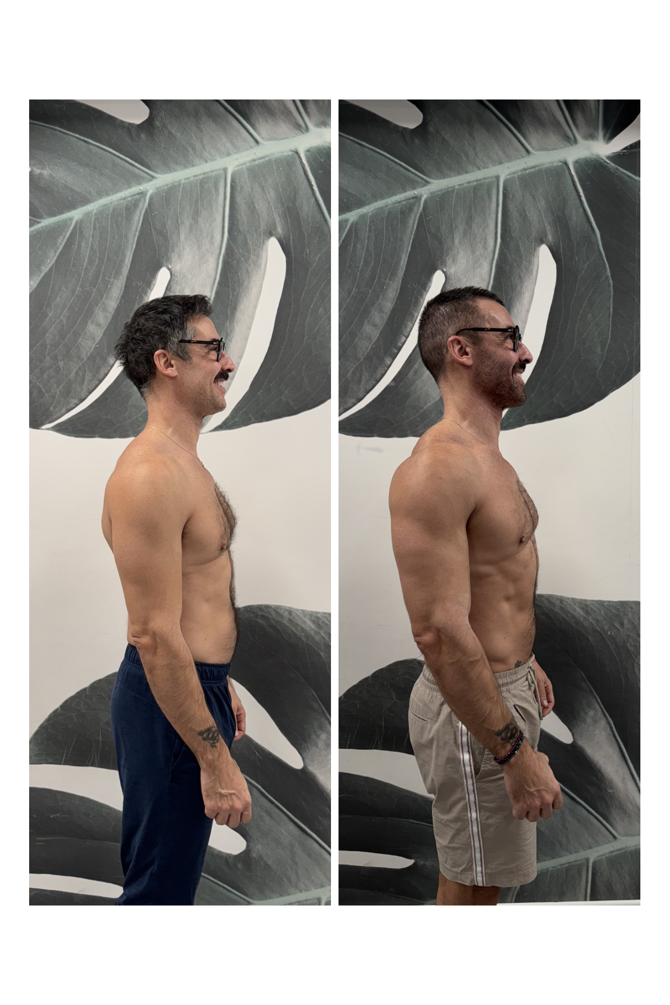 Transformation vue dos