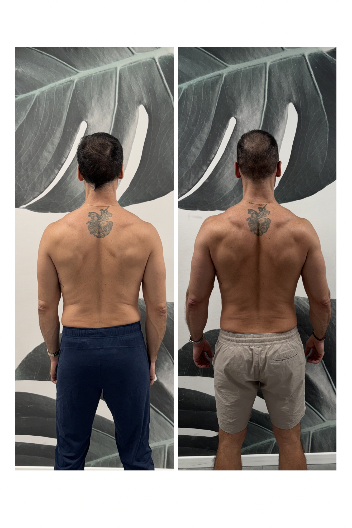 Transformation face complète